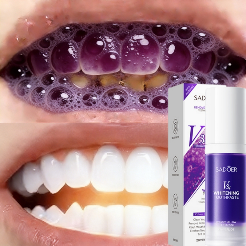 Teeth Whitening Effective - 2026 Bestselling Whitening Toothpaste Effectively Remove