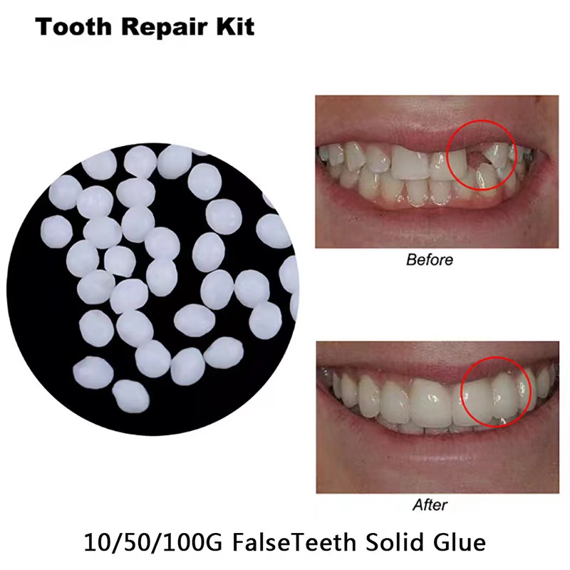 Teeth Whitening Mask - 10g/bag Tooth Repair Kit-thermal Beads For