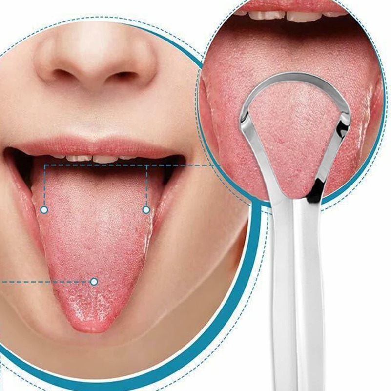 Tongue Scraper Metal - Clean Tongue Scraper Tongue Remover Halitosis