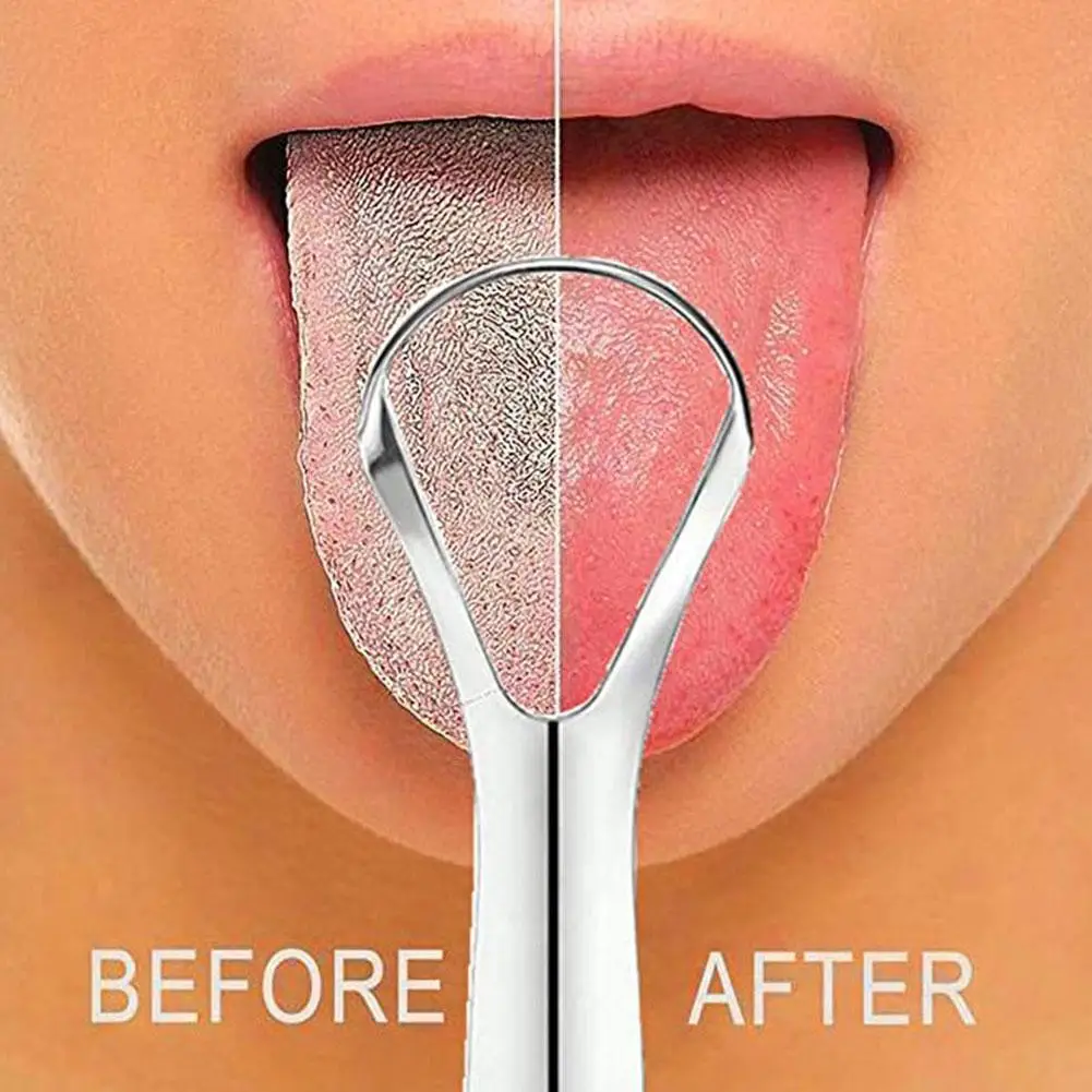 Tongue Scraper Metal - 1-20pc Tongue Scraper, Stainless Steel Tongue
