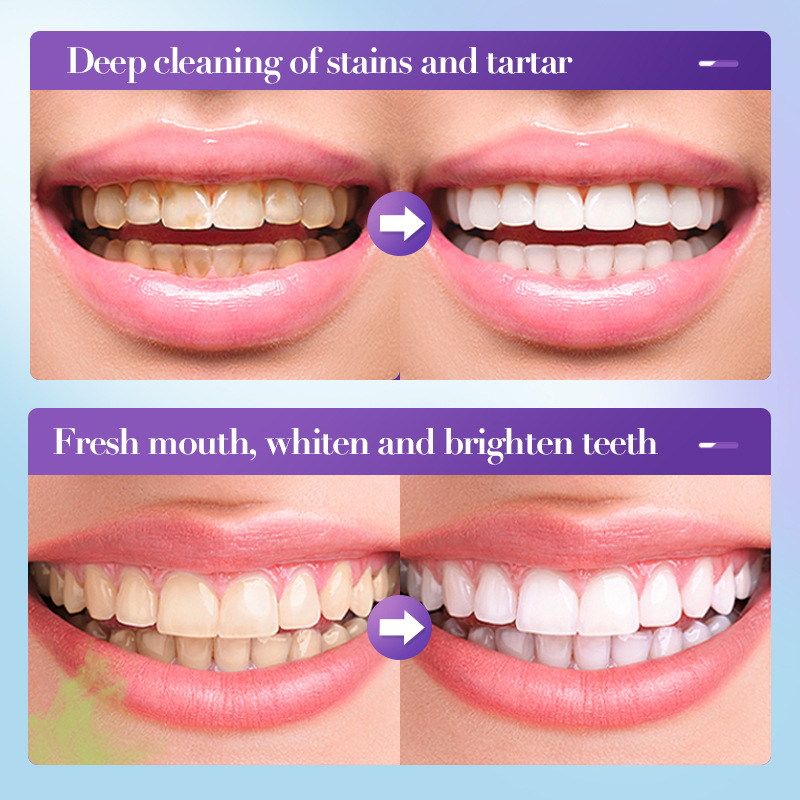 2026 Bestselling Whitening Too - Teeth Whitening Effective 评论和价格