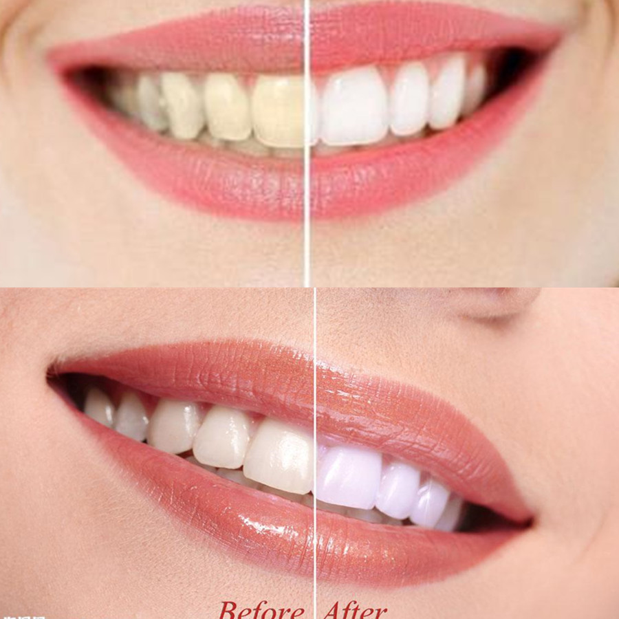 Bamboo Charcoal Teeth Tooth De - Teeth Whitening Results 评论和价格