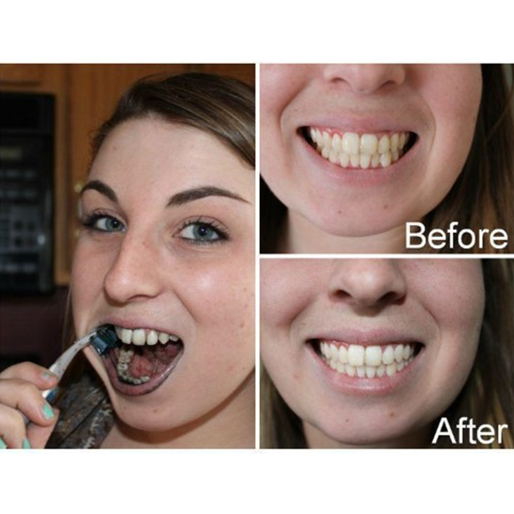 Bamboo Charcoal Teeth Tooth De - Teeth Whitening Results 评论和价格