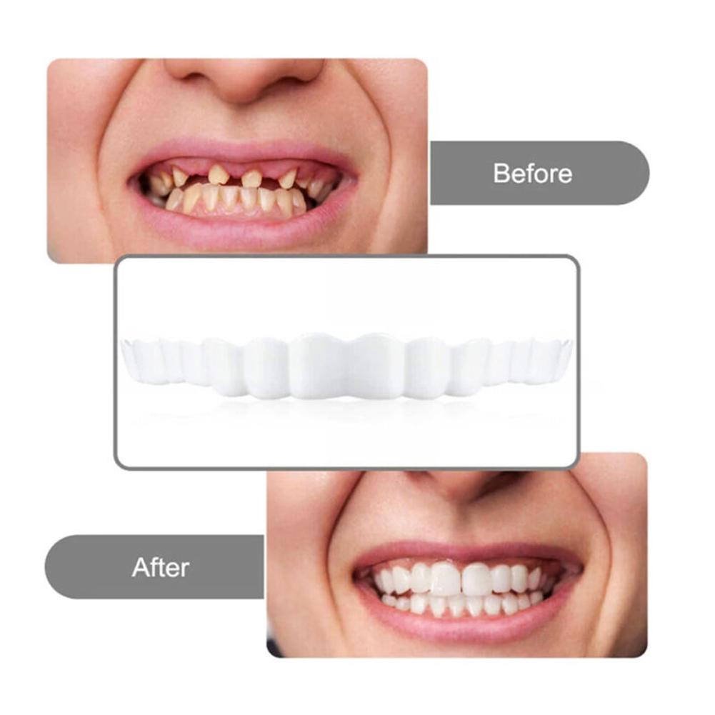 4-6 Pairs Upper&Lower Jaw Dent - Teeth Whitening Mask 评论和价格