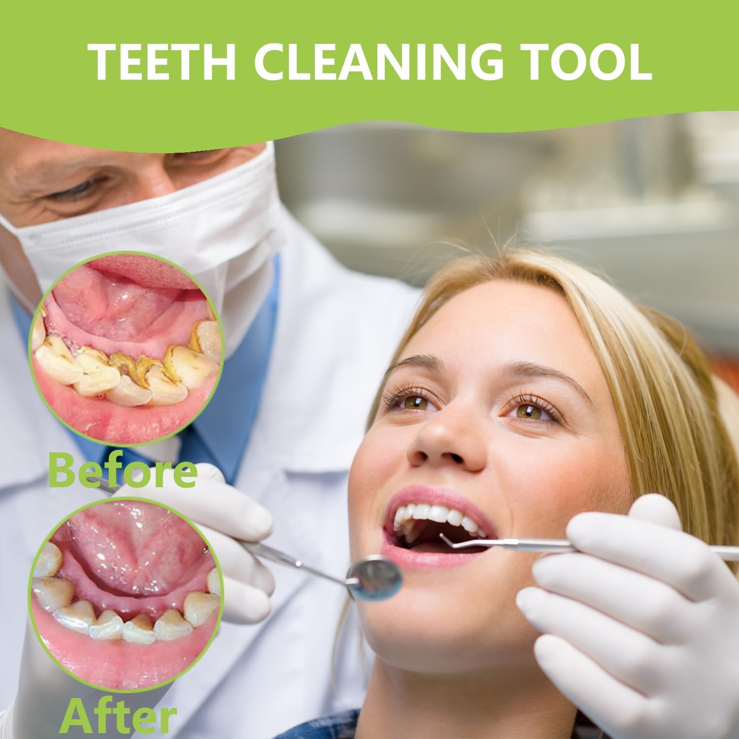 Professional Teeth Cleaning Or - Teeth Whitening Mouthwash 评论和价格