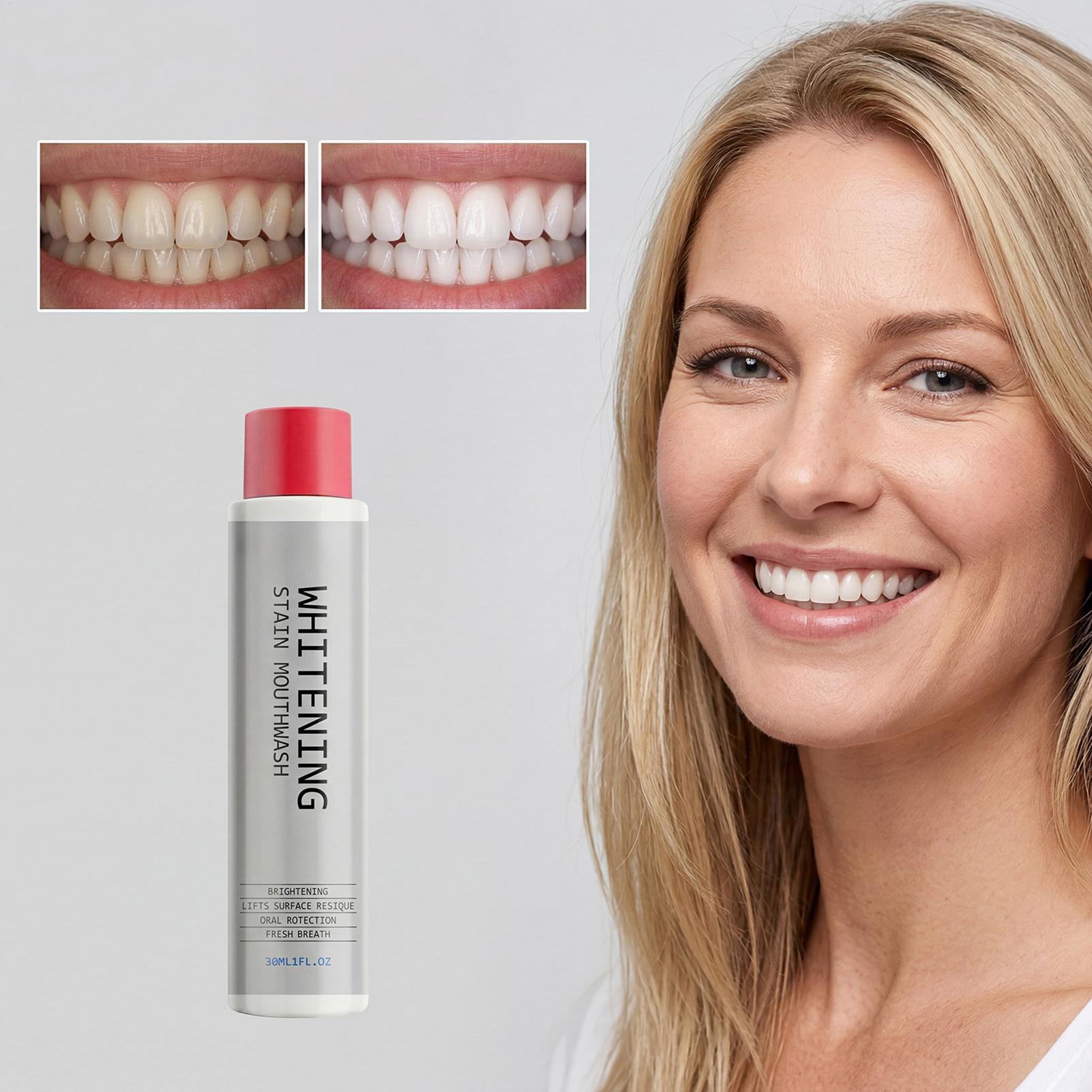 30ml Stain Whitening Mouthwash - Teeth Whitening Mouthwash 评论和价格