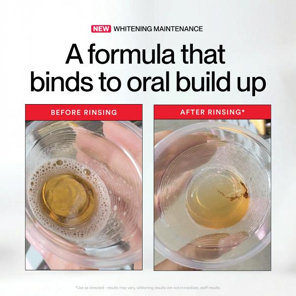 Hismile ID Whitening Stain Mou - Teeth Whitening Mouthwash 评论和价格