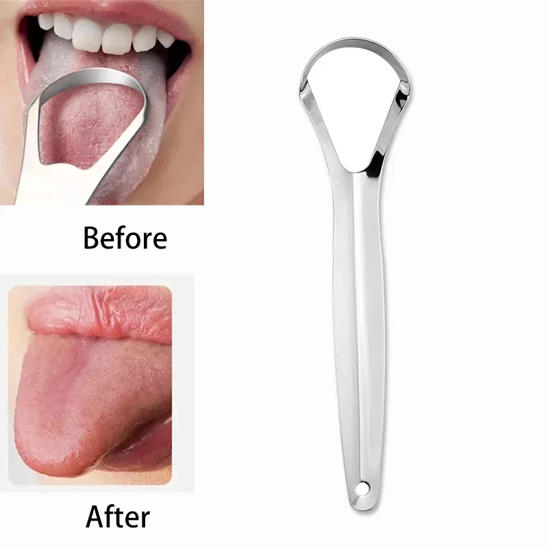 Halitosis Tongue Coating Tongu - Tongue Scraper Metal 评论和价格