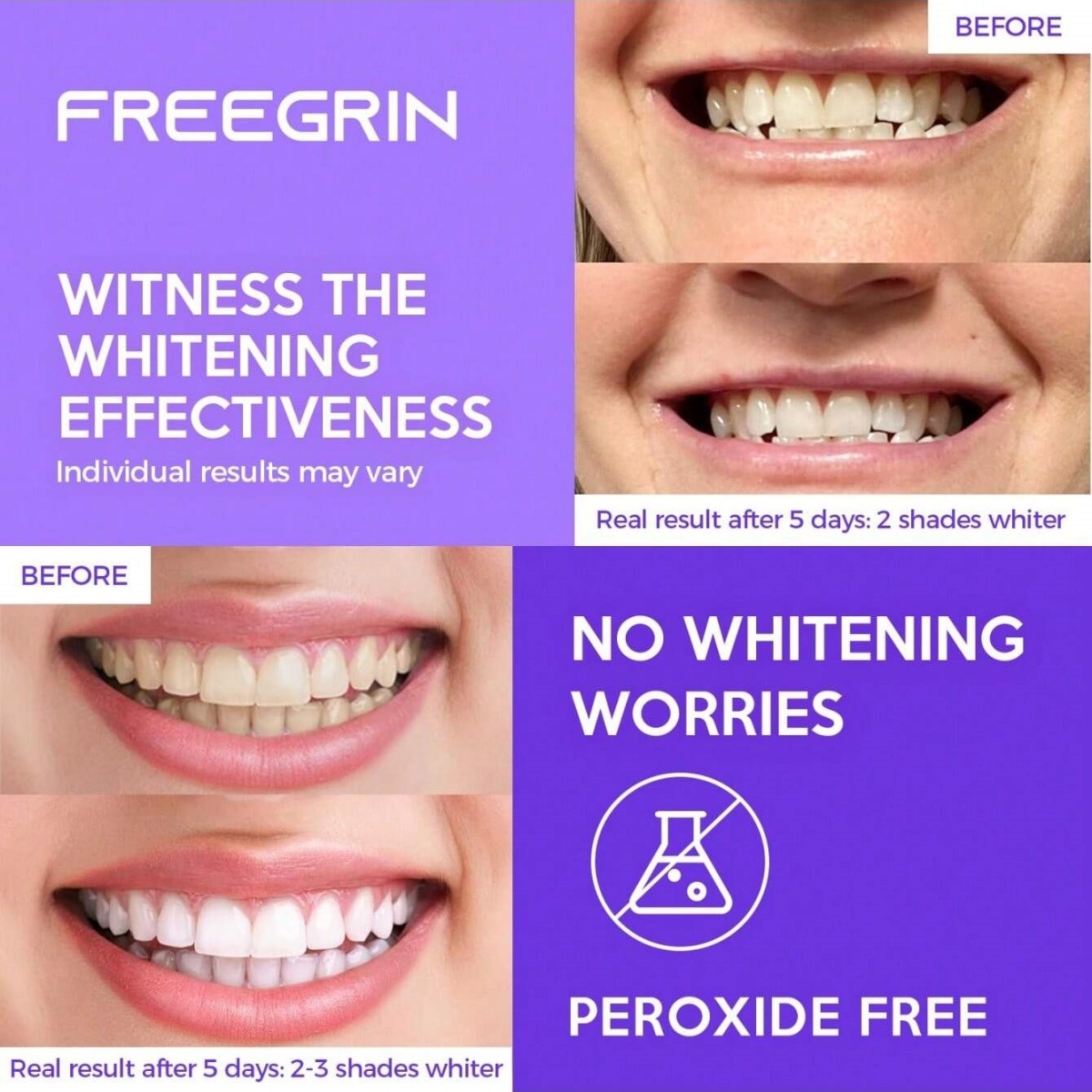 Deluxe Whitening Teeth Sticker - Teeth Whitening With Peroxide 评论和价格