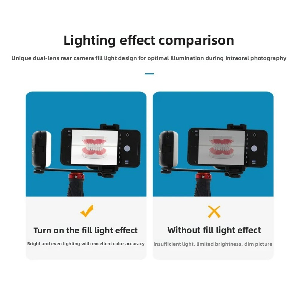Dental Photography Light, Blue - Teeth Whitening Kit With Light 评论和价格