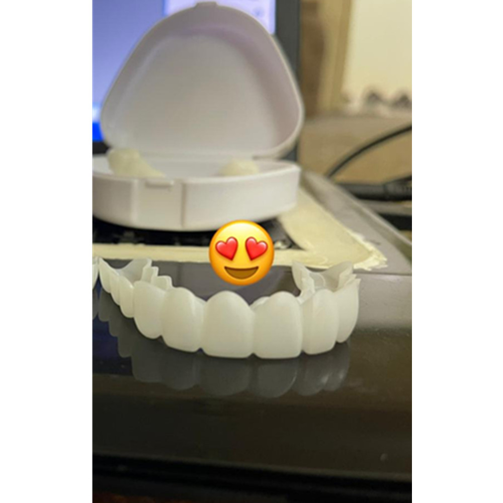 On Smile Dental Upper Lower Fa - Teeth Whitening Mask 评论和价格