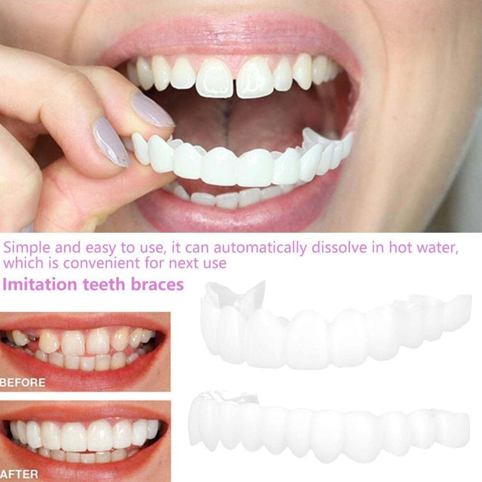 2pcs Men Women Temporary Teeth - Teeth Whitening Mask 评论和价格