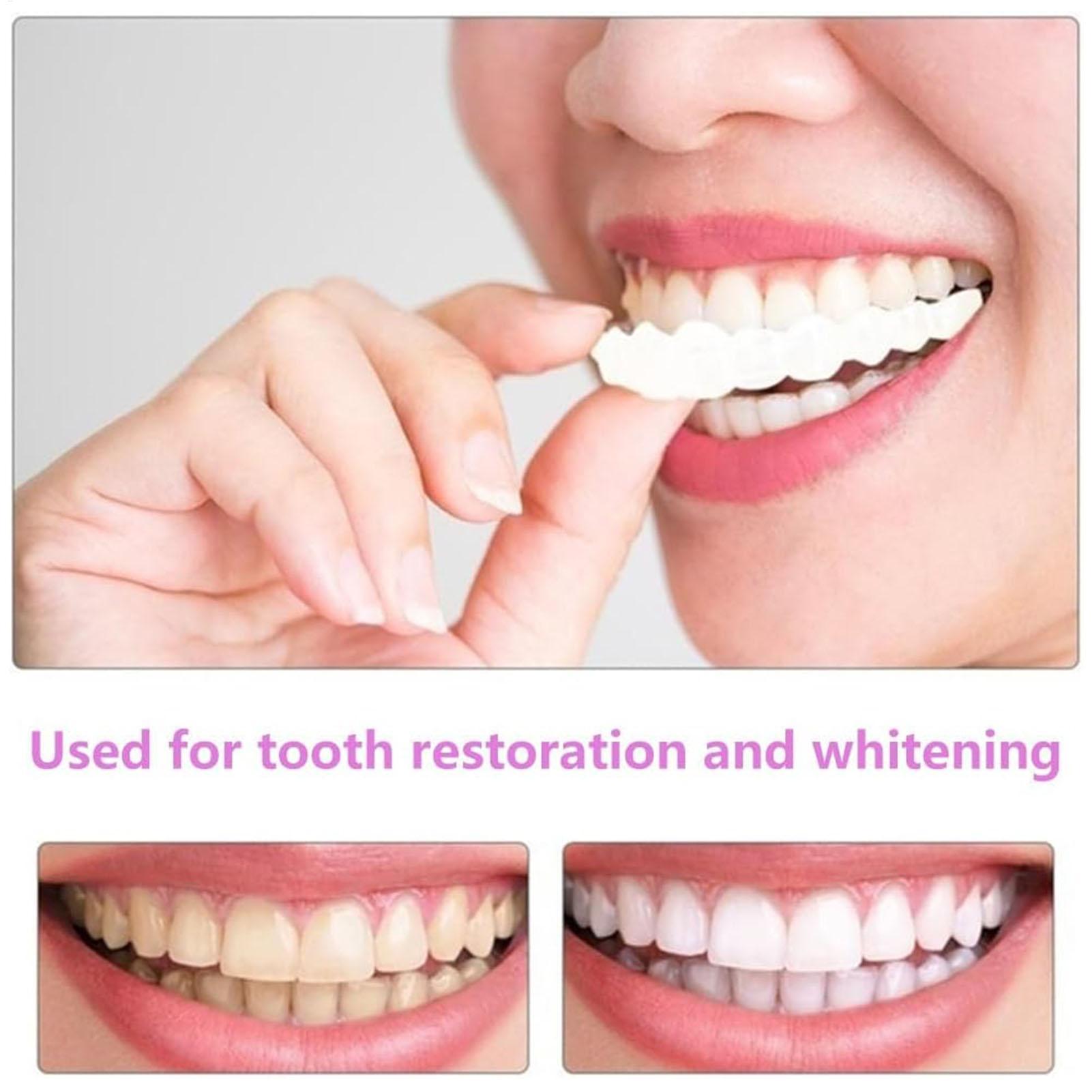 2pcs Men Women Temporary Teeth - Teeth Whitening Mask 评论和价格