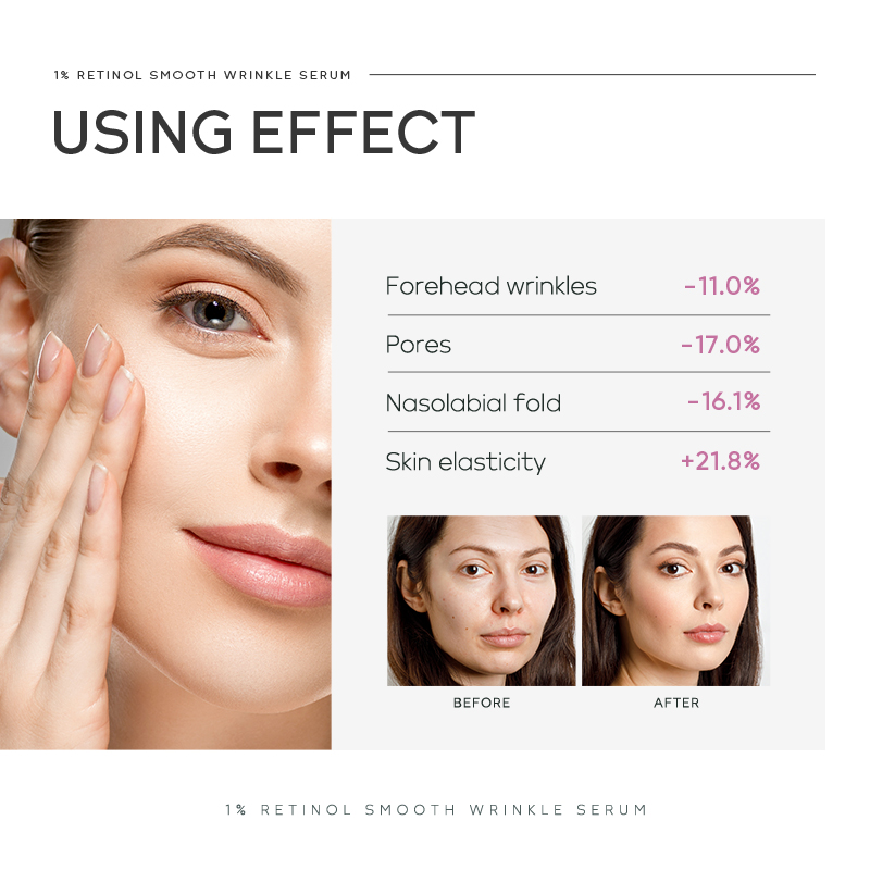Quiyum 1% Retinol Smooth Wrink - The Ordinary Serum Hyaluronic Acid 评论和价格