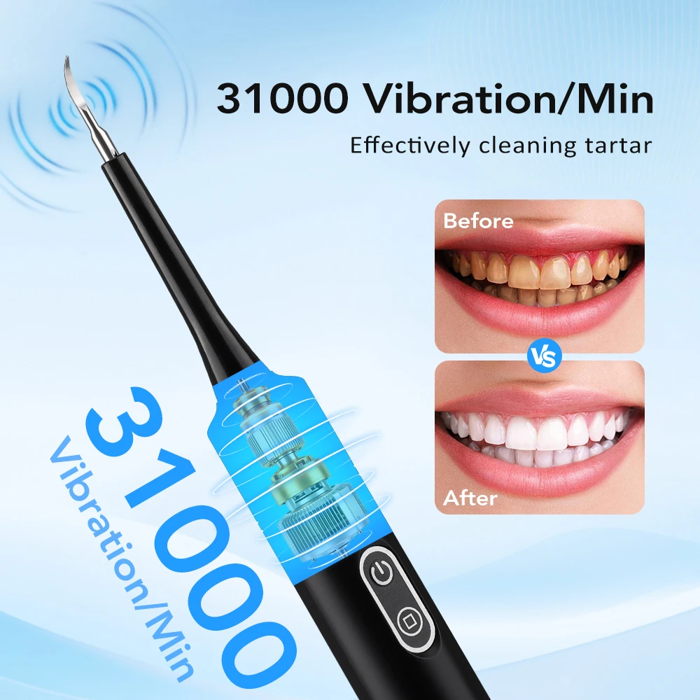 Electric Sonic Vibration Denta - Teeth Whitening Mouthwash 评论和价格
